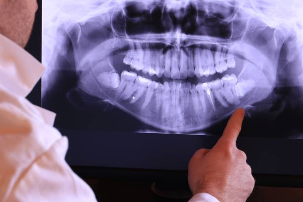 Best Emergency Tooth Extraction in Woodlake, CA